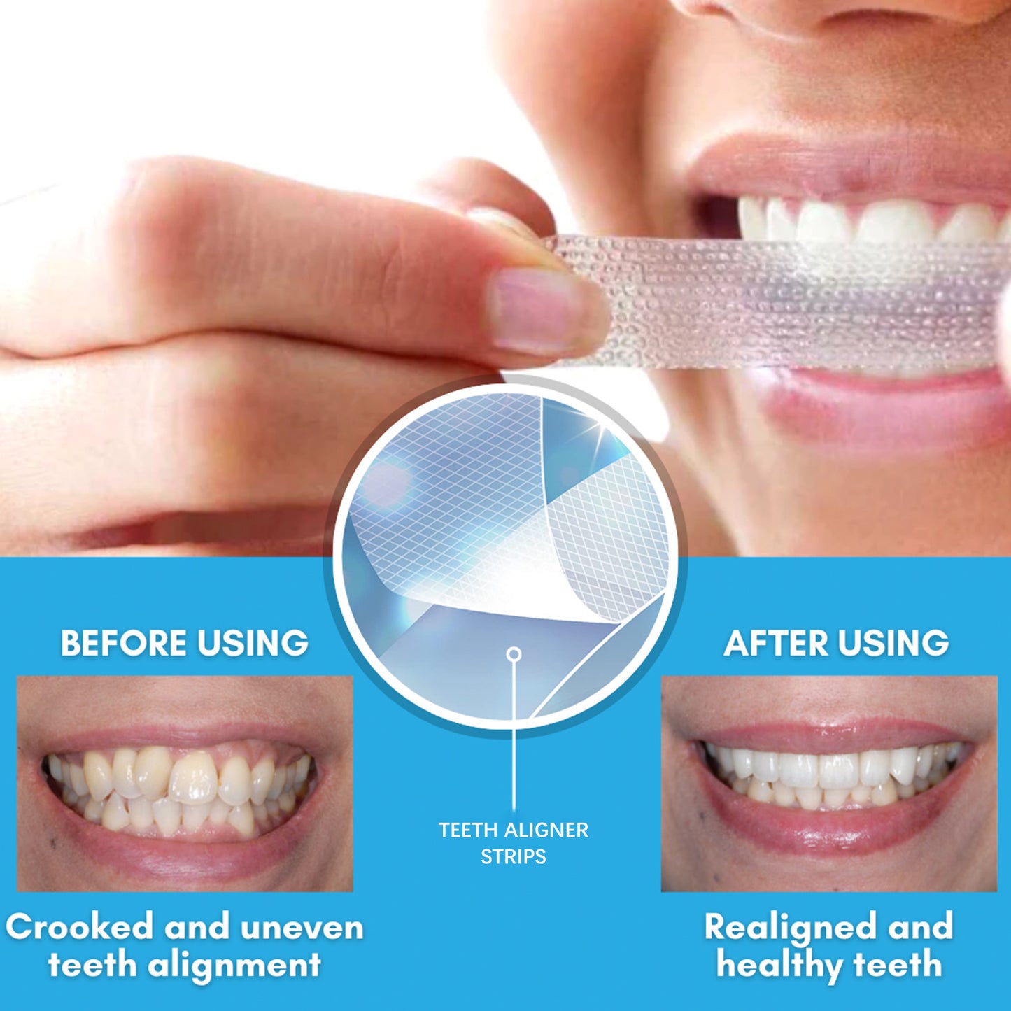 Whitening Dental Patches | Cleanliness and Beauty for Teeth